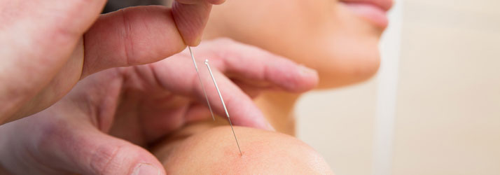 Pain Management Phoenix AZ Acupuncture For Pain Management