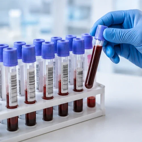 Chronic Pain Phoenix AZ Vials of Blood in a Lab